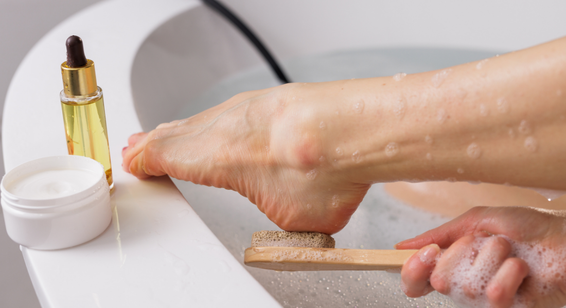 Tea tree voor voeten: toepassingen bij zweetvoeten en voetschimmel | Varuvo